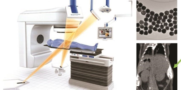 Image Guided Radiotherapy